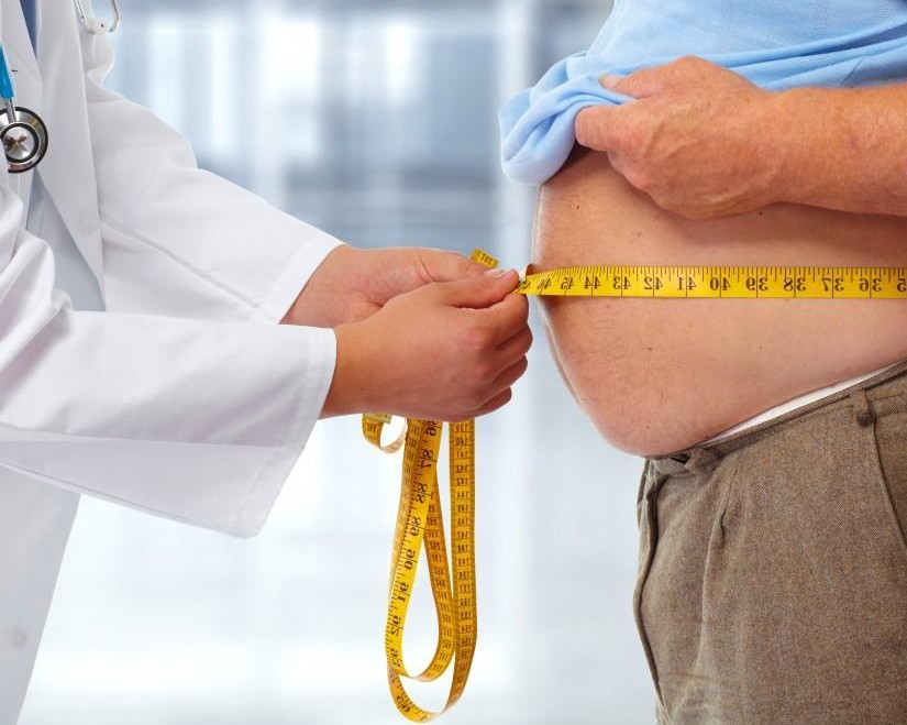 Bariatric Surgery