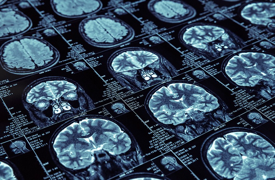 Neurosurgery