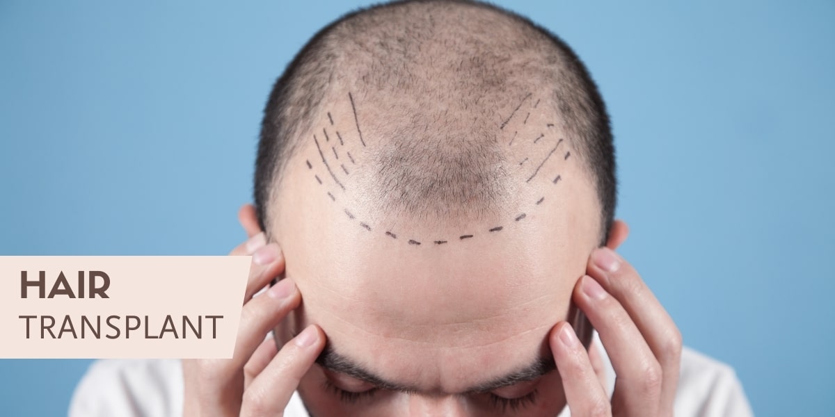 Slider - Hair Transplant